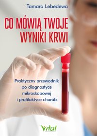 Co mówią twoje wyniki krwi - Piotr Lewiński, Tamara Lebedewa